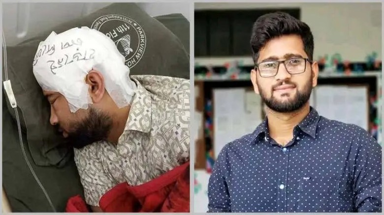 দুই মাস ফ্রিজে রাখা খুলির অংশ পুনঃপ্রতিস্থাপন পেলেন মামুন